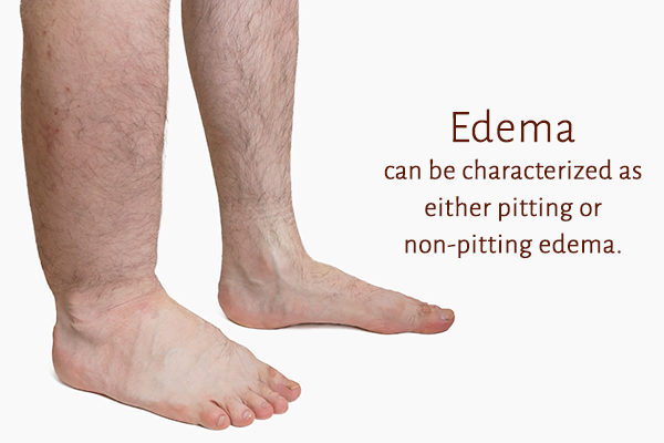 different stages of edema