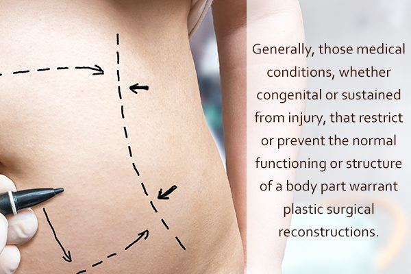 medical conditions that require a plastic surgery