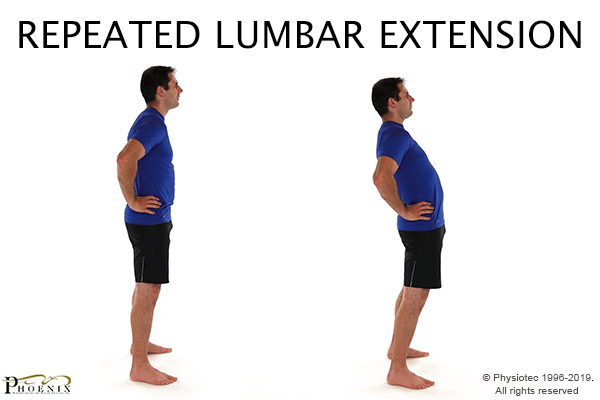 repeated lumbar extension for sciatic nerve pain