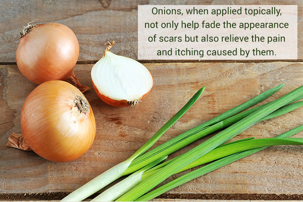 onions can help remove scars