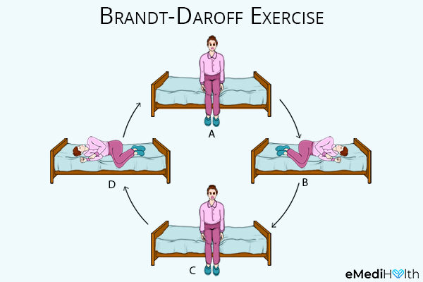 performing brandt-daroff exercises can help prevent vertigo