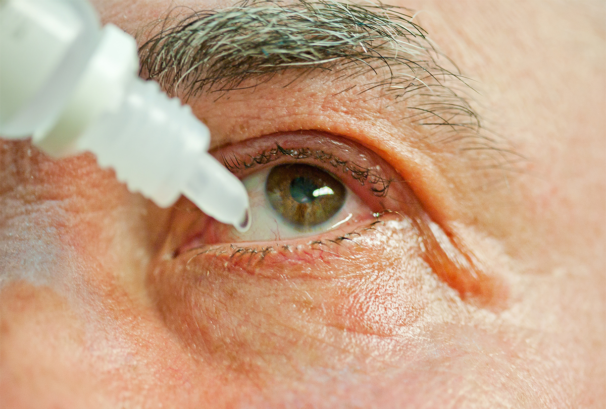 at-home remedies to soothe itchy eyes