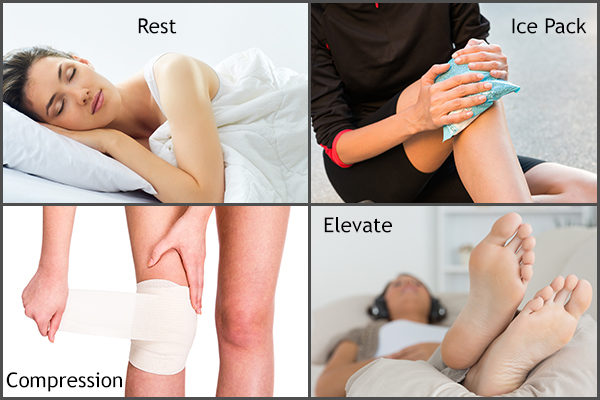 follow RICE to manage knee pain