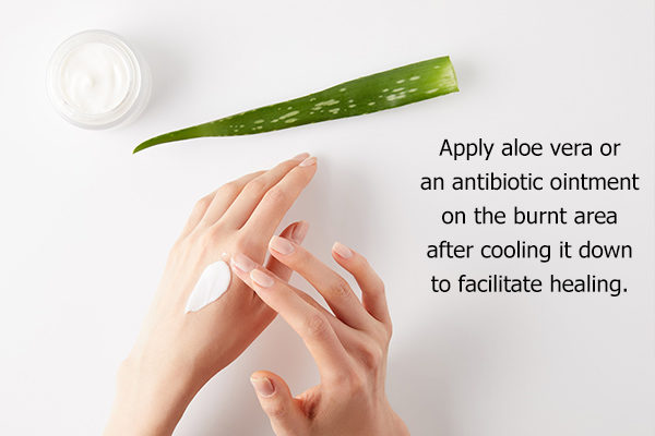 remedies for minor burns