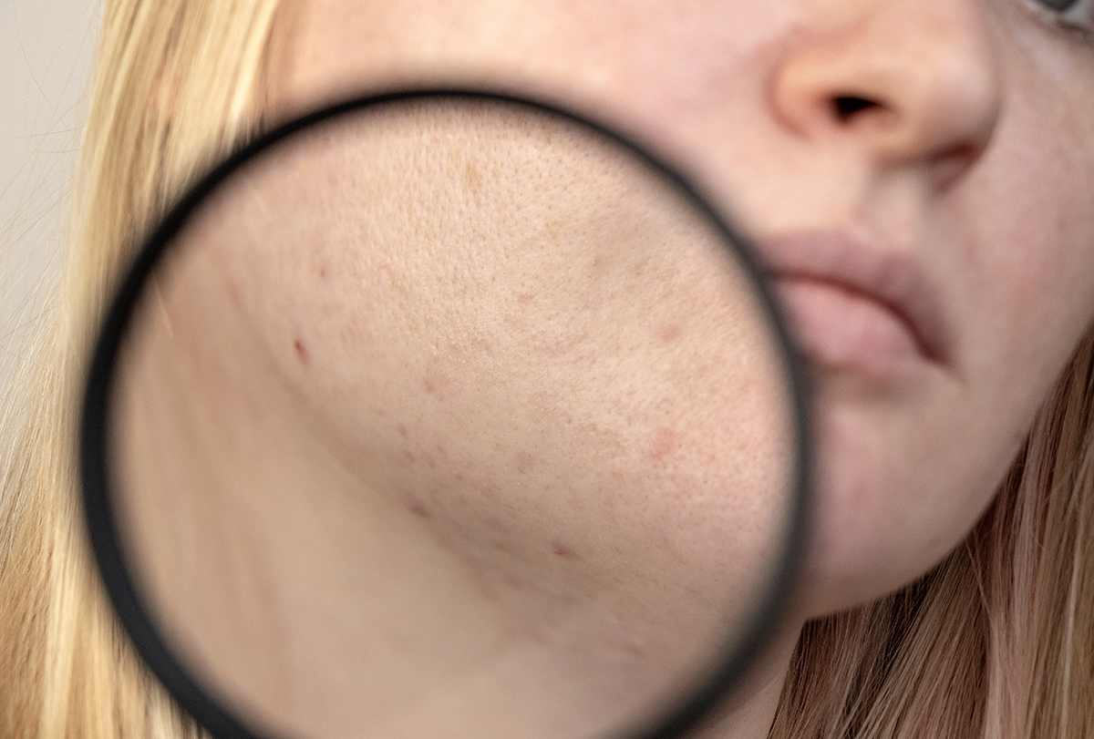 reasons for dark spots on face