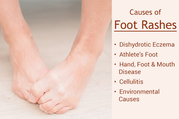 what causes a foot rash?