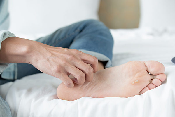 complications of untreated foot rashes