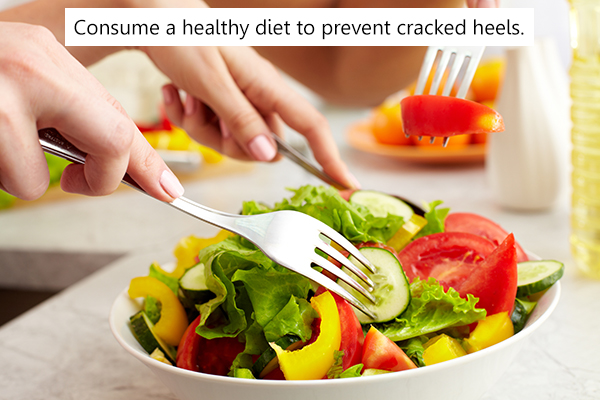consuming a healthy diet may help in preventing cracked heels