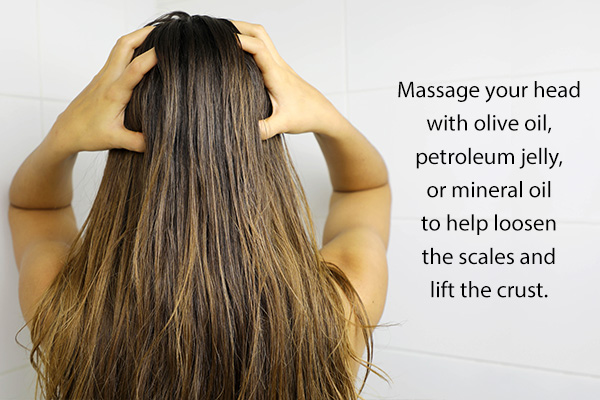 self-care treatment options for itchy scalp