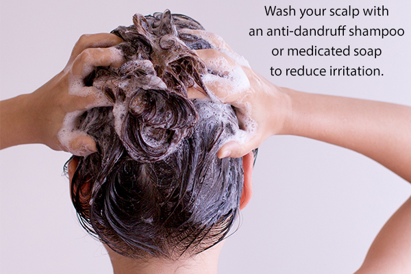 regularly wash your scalp