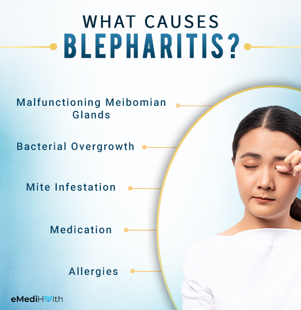 what are the causes behind blepharitis?