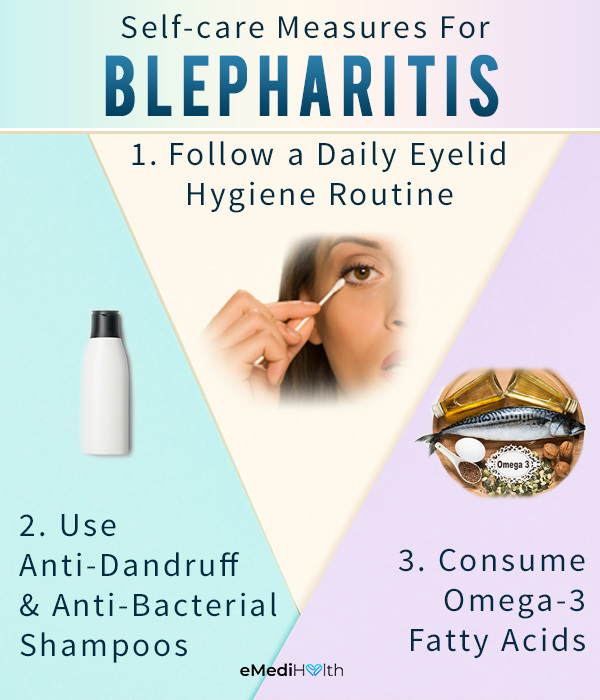 self-care measures to prevent blepharitis