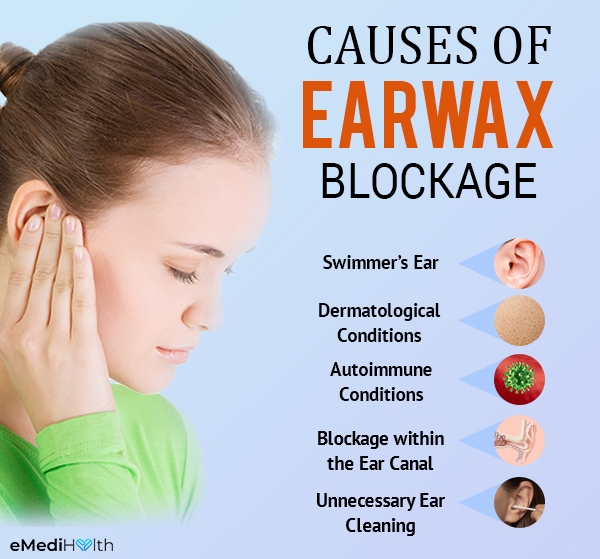 what causes earwax buildup?