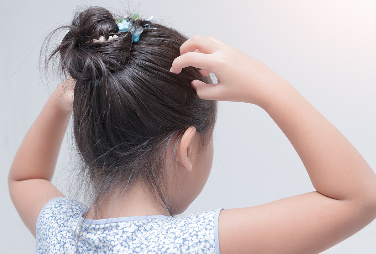 at-home remedies for head lice infestation