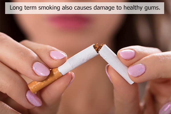refrain from smoking to avoid tooth staining