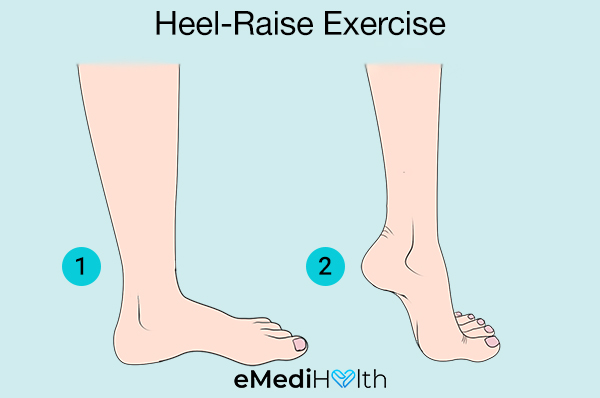 heel-raise exercise for bunion pain relief