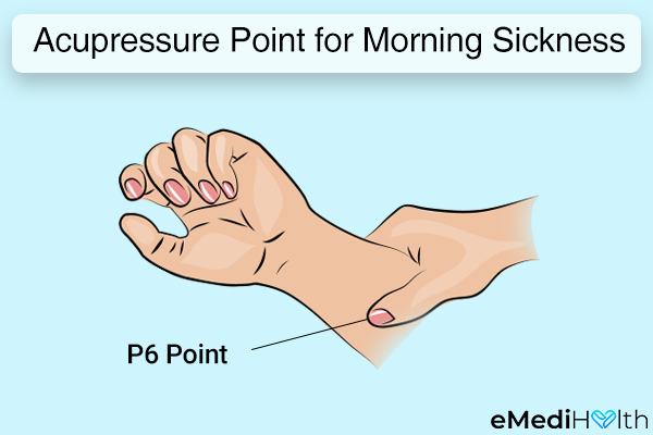 acupressure can help reduce the symptoms of morning sickness