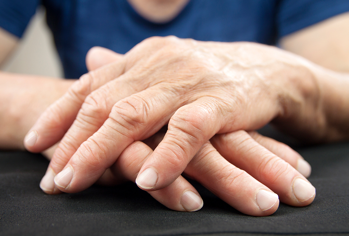at-home remedies to cure rheumatoid arthritis