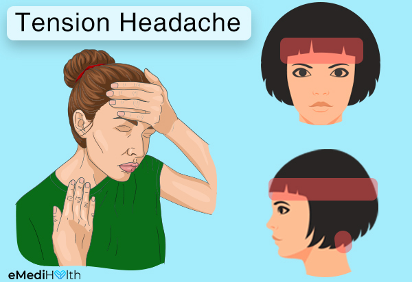 what causes tension headaches?