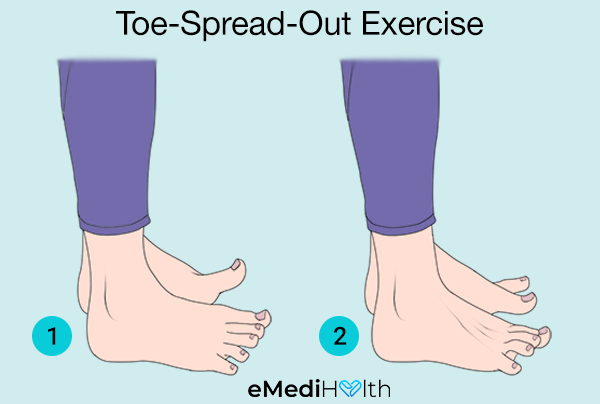 toe-spread-out-exercise for bunion pain relief