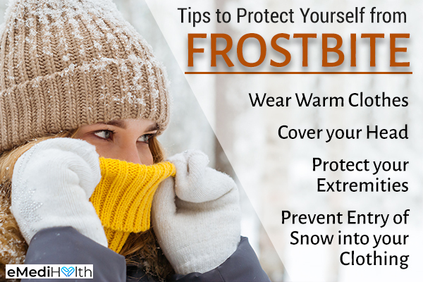 tips that can help prevent frostbite