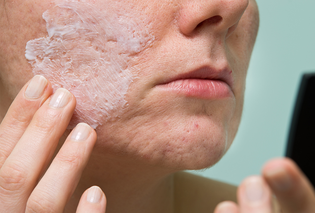 diy acne face masks