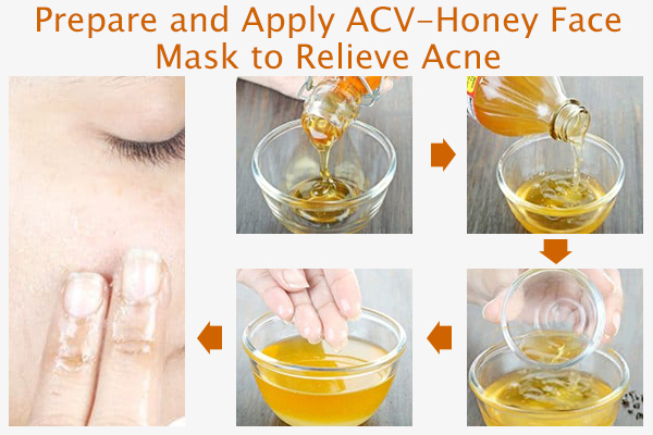 prepare and apply acv acne face mask