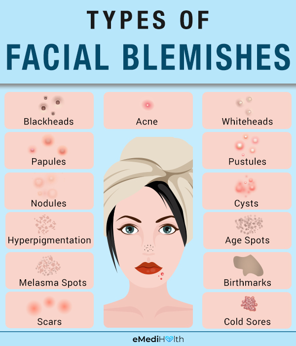types of facial blemishes