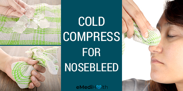 applying a cold compress can help stop a nosebleed