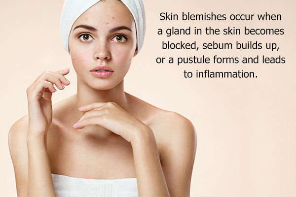 acne is a common skin ailment
