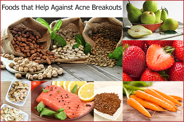 foods that can help curb acne breakouts