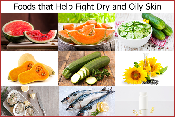 foods that can help you fight dry and oily skin