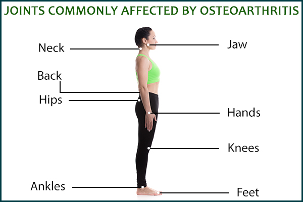 joints commonly affected by osteoarthritis