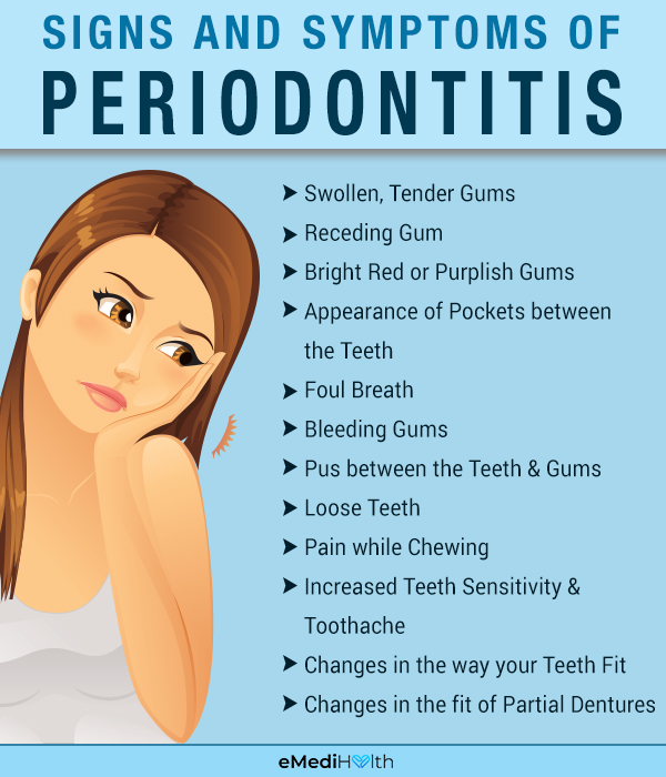 symptoms of periodontitis