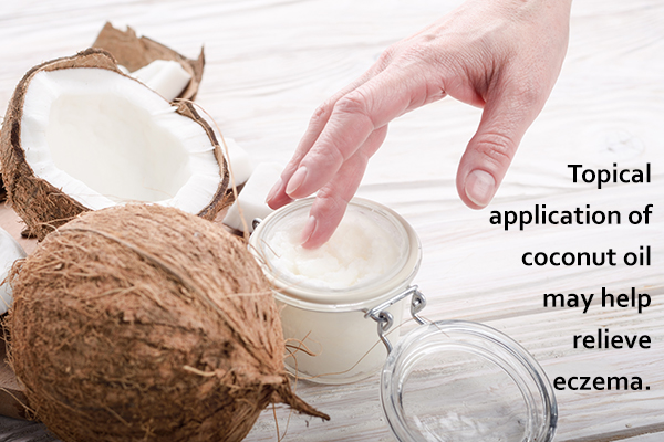 coconut oil application can help relieve itchy skin