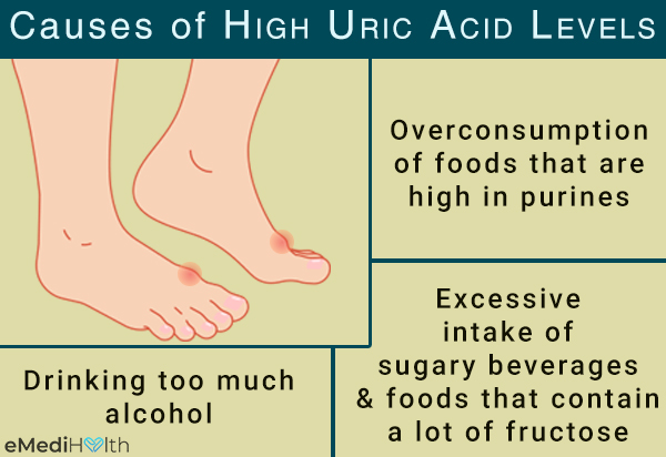 causes of gout