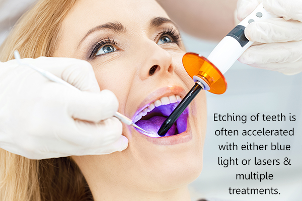 dental treatments for stained teeth