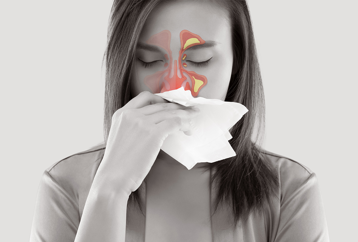 dealing with sinusitis