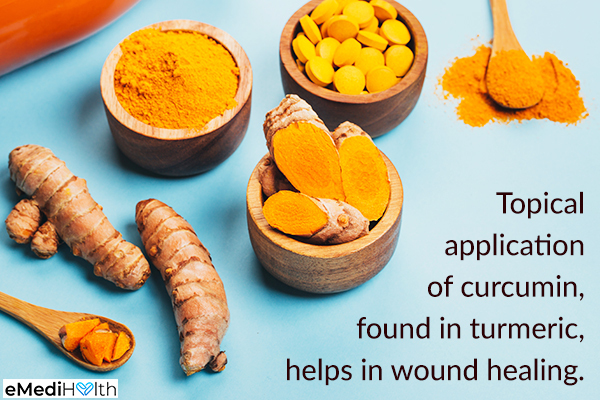 topical application of turmeric accelerates wound healing