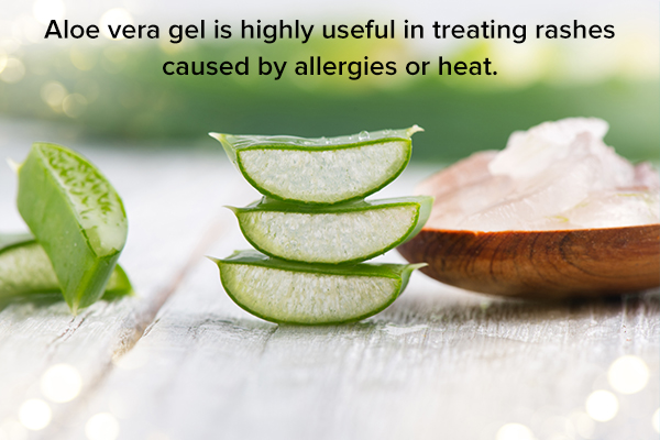 aloe vera gel can help soothe skin rashes