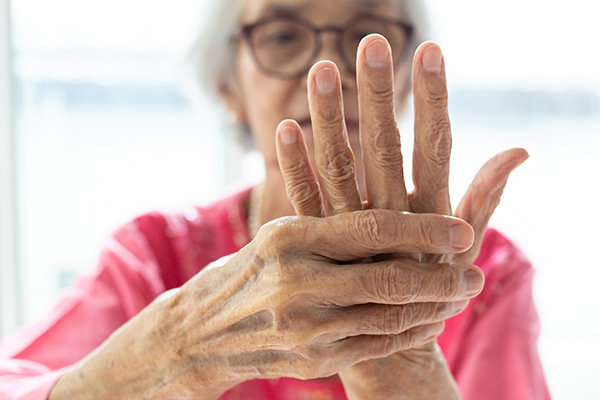 general queries about arthritis of the hand