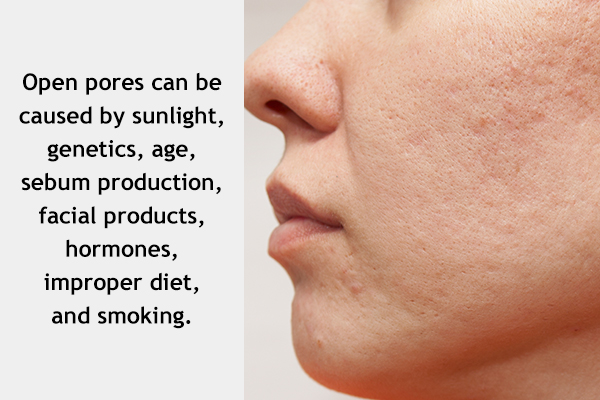 factors that can contribute to open pores