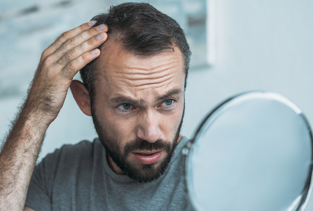 hair loss causes, symptoms, treatment and diagnosis