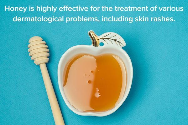 honey can be used to treat skin rashes