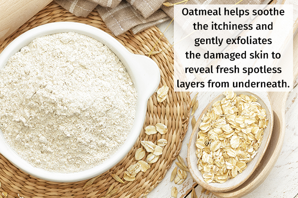 oatmeal helps soothe itchiness and eczema symptoms