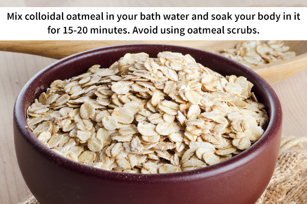 oatmeal bath for sunburn