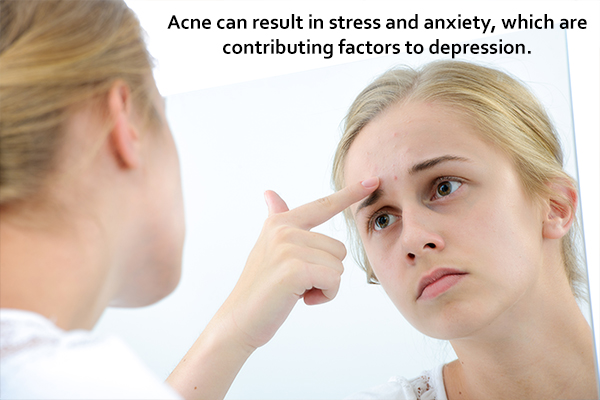 Psychological implications of acne