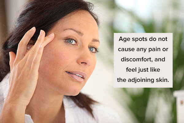 common symptoms associated with age spots