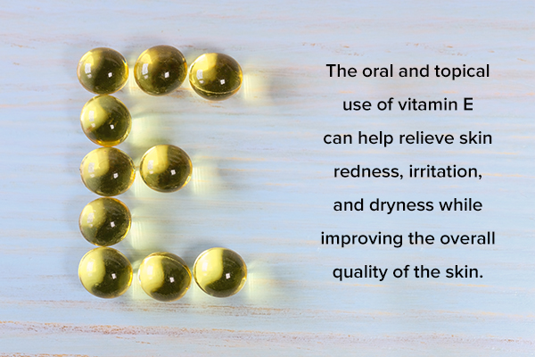 oral and topical use of vitamin E oil and capsules can help