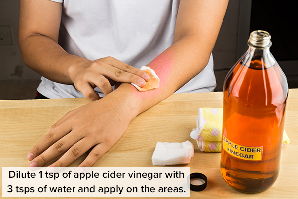 apple cider vinegar can help control and manage boils